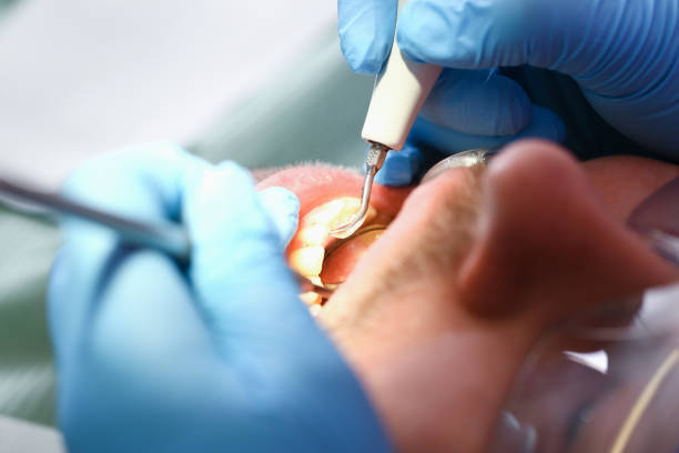 Best Broken or Cracked Tooth Emergency Dentist in Middlebranch, OH