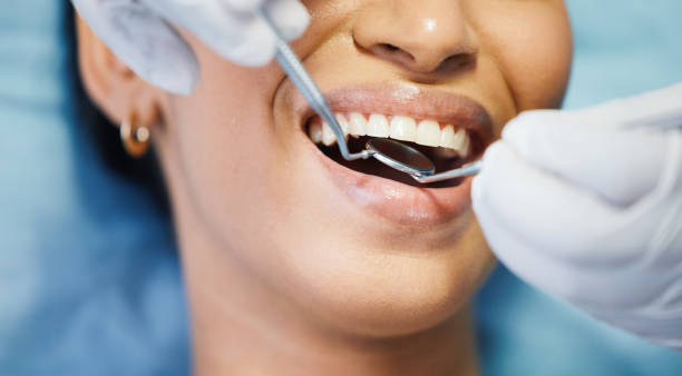 Best Weekend Emergency Dentist in Middlebranch, OH
